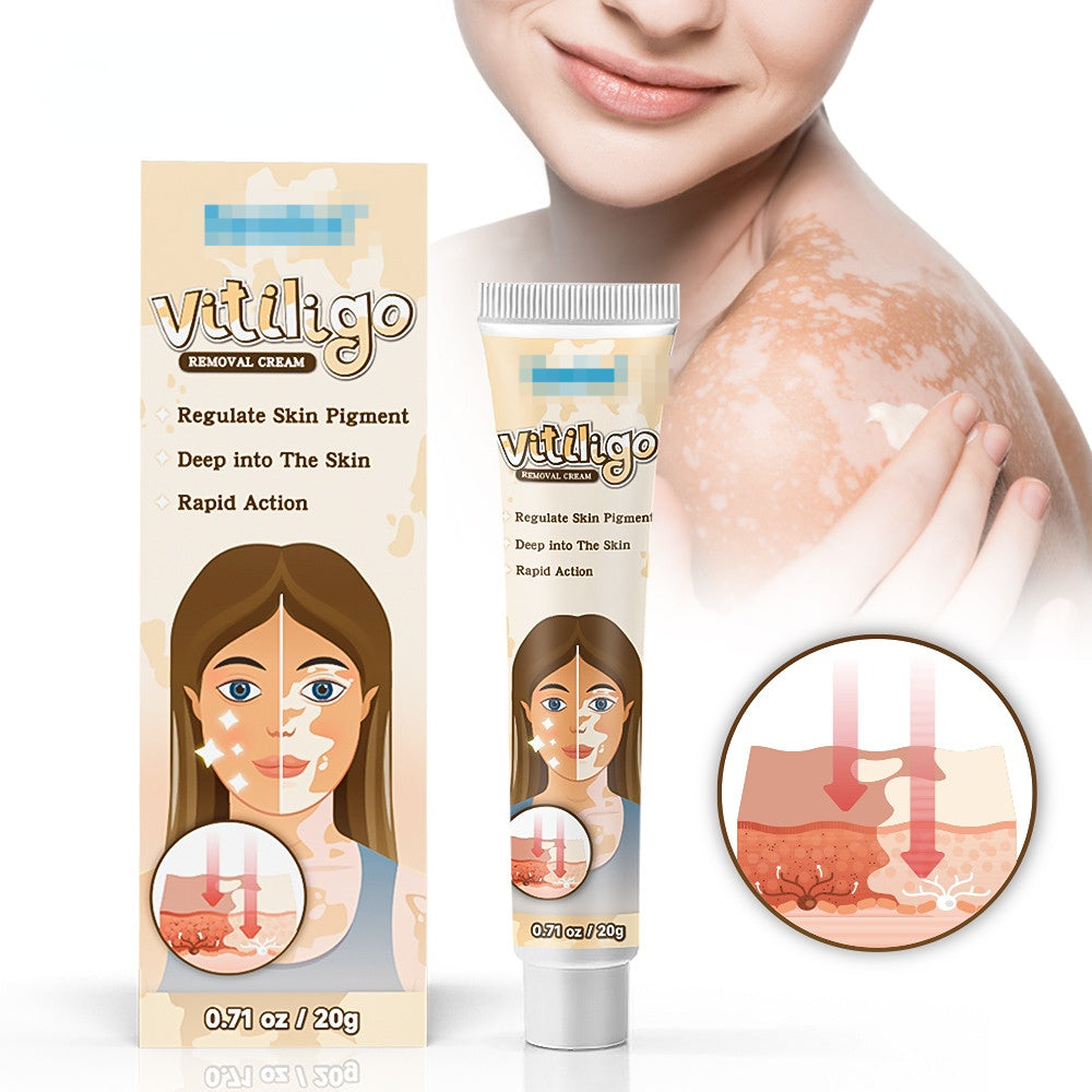 20g Baibanjing YI Bacterial Ointment for Vitiligo Repair 白斑净抑菌膏20g