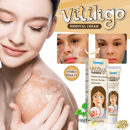 20g Baibanjing YI Bacterial Ointment for Vitiligo Repair 白斑净抑菌膏20g